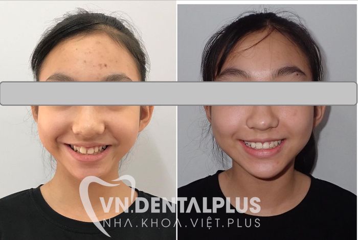 Hình ảnh 2 của Nha Khoa Việt Plus