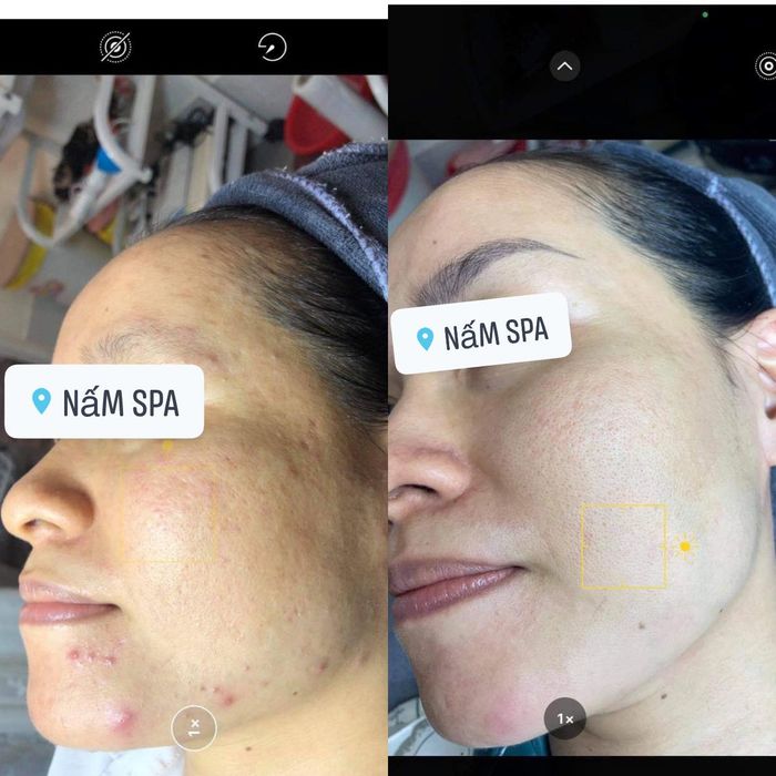 Nấm Spa hình 1