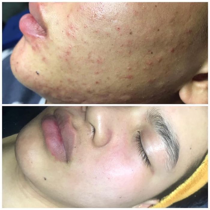 Hình ảnh Spa Diệu Hiền 2