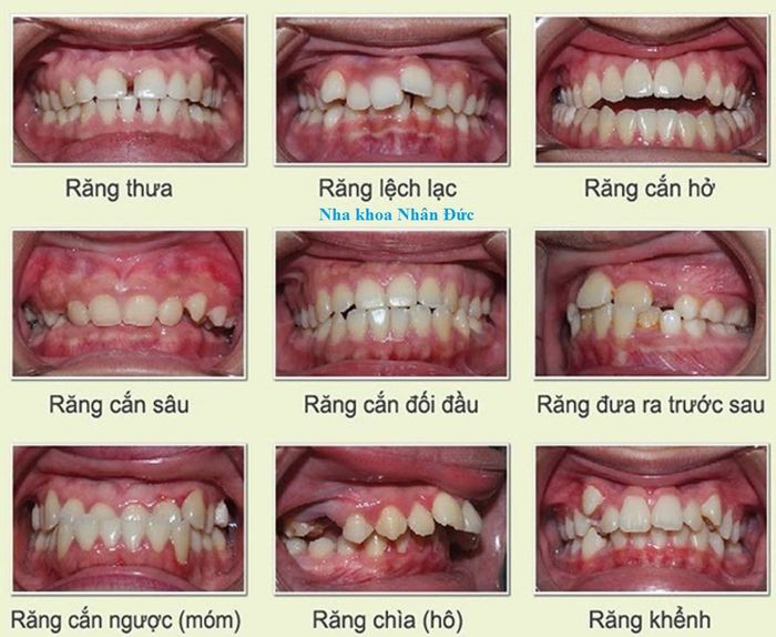 Hình ảnh NHA KHOA NHÂN ĐỨC 2