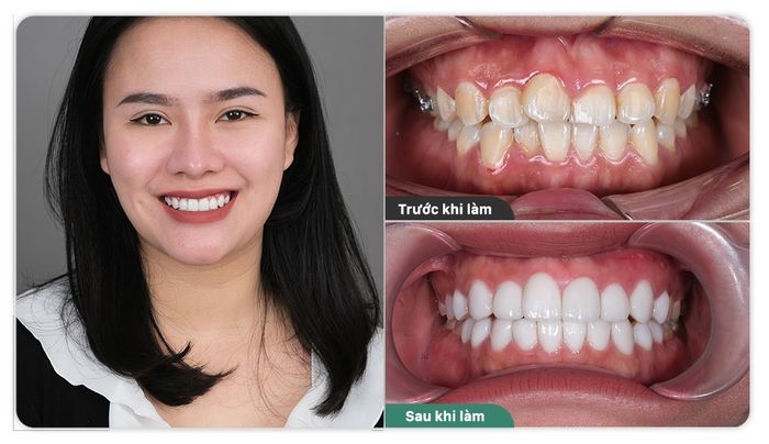 Hình ảnh Nha Khoa Pháp Việt - Sa Đéc số 1