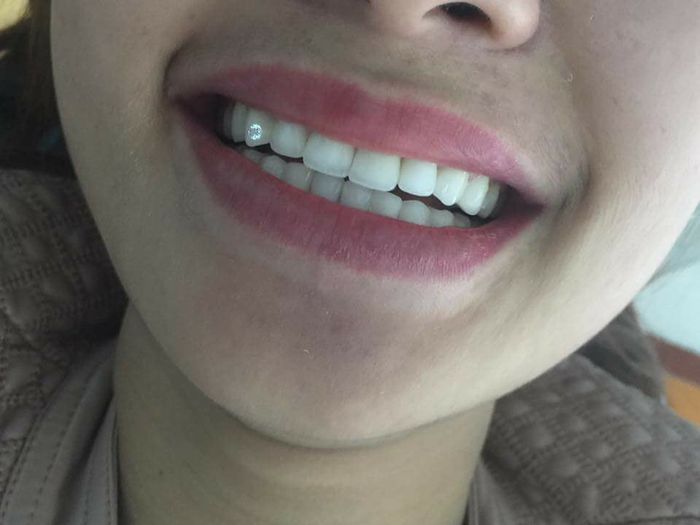 Nha Khoa Hà Nội hình 1