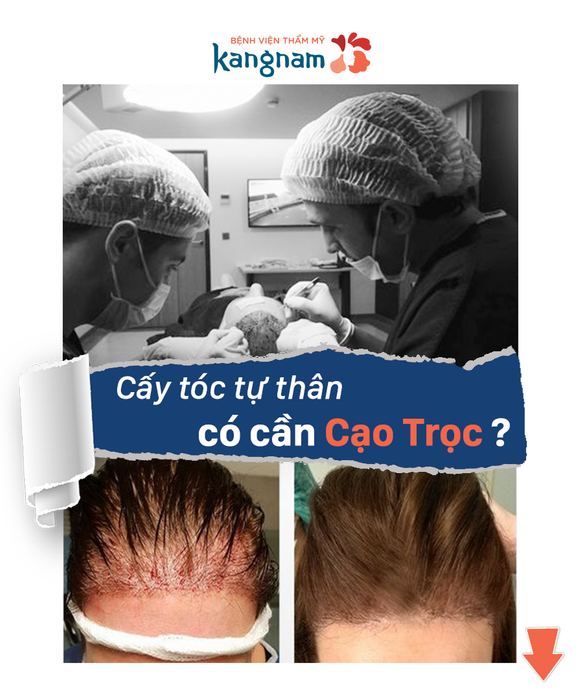 Bệnh viện Thẩm mỹ Kangnam - Hình ảnh 2