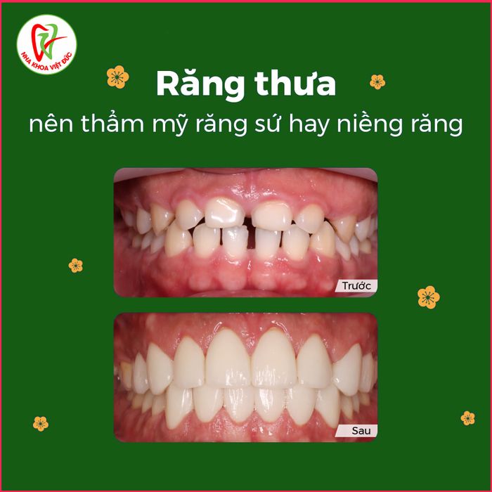 Ảnh Nha Khoa Việt Đức 1