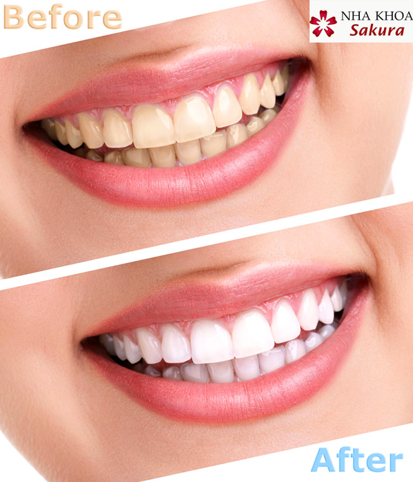 Hình ảnh 1 của Nha Khoa Sakura