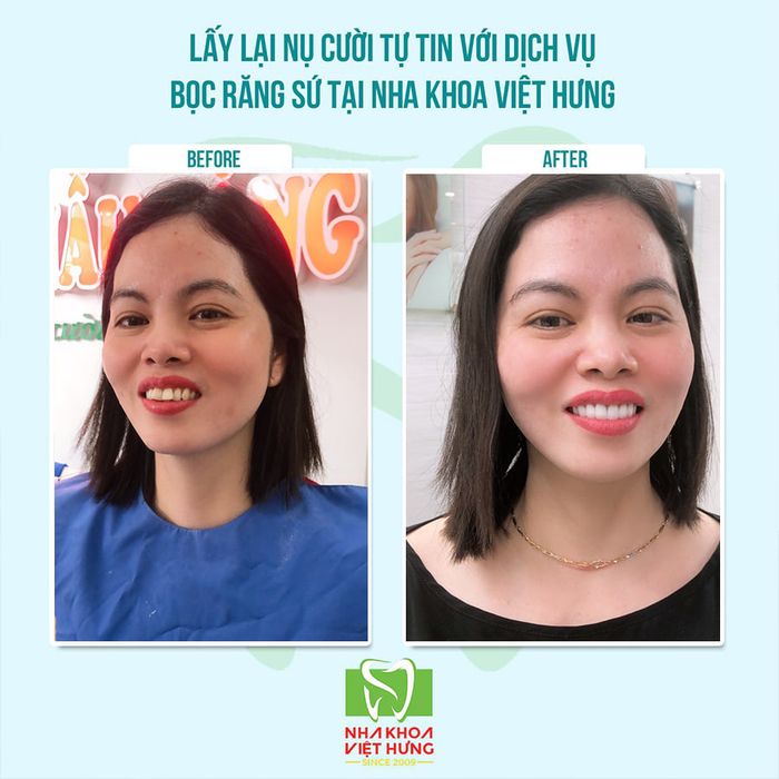 Nha Khoa Thẩm Mỹ Việt Hưng hình 1