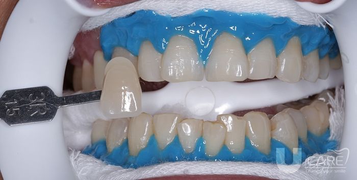 Hình ảnh Ucare Dental 2