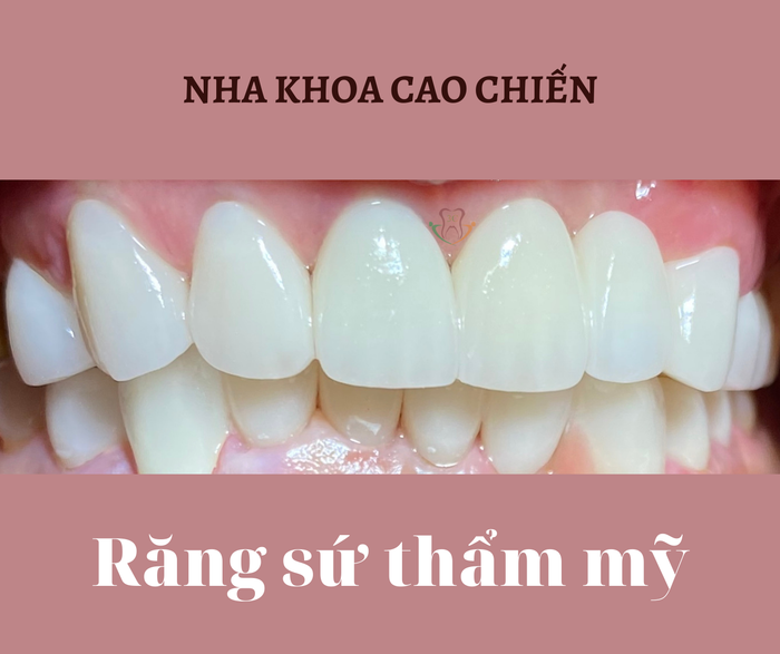 Nha khoa Cao Chiến - Hình ảnh 2