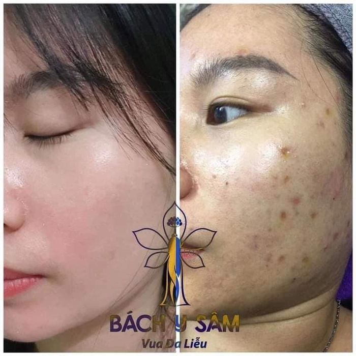 Hình ảnh Spa Nhật Linh 2
