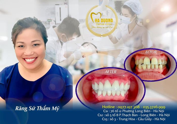 NHA KHOA HÀ ĐƯƠNG - Hình ảnh 2