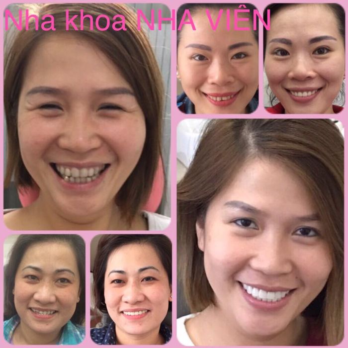 Nha Khoa NHA VIÊN hình 1