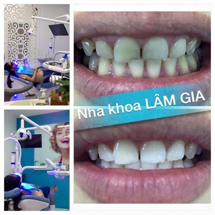 Hình ảnh Nha Khoa Lâm Gia 1
