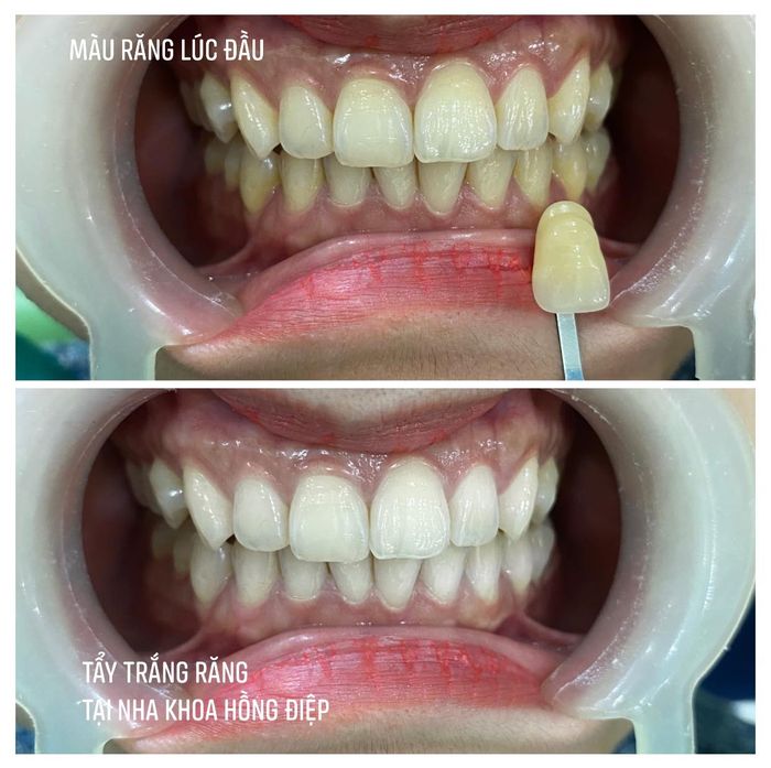 Hình ảnh 1 của Nha khoa Hồng Điệp