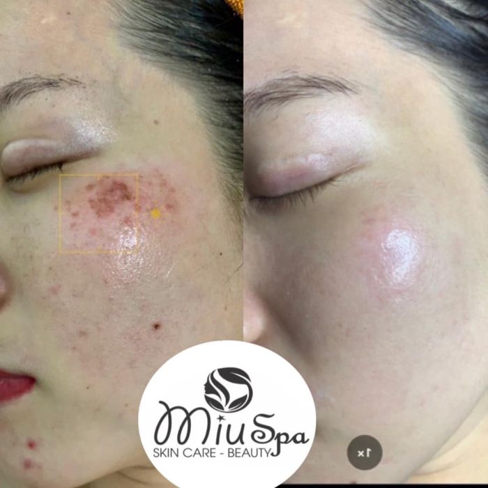 Hình ảnh Miu Spa số 2