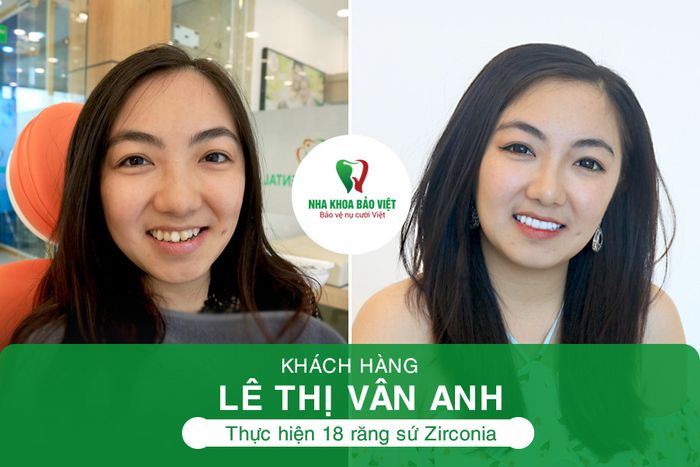 Hình ảnh Nha Khoa Bảo Việt 1