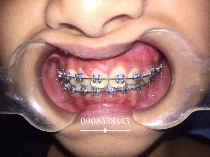 Hình ảnh NHA KHOA NHÂN ĐỨC 1