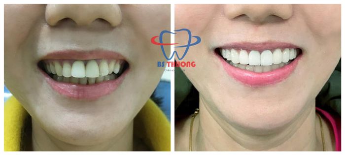 Nha Khoa BS Thương - Hình 1