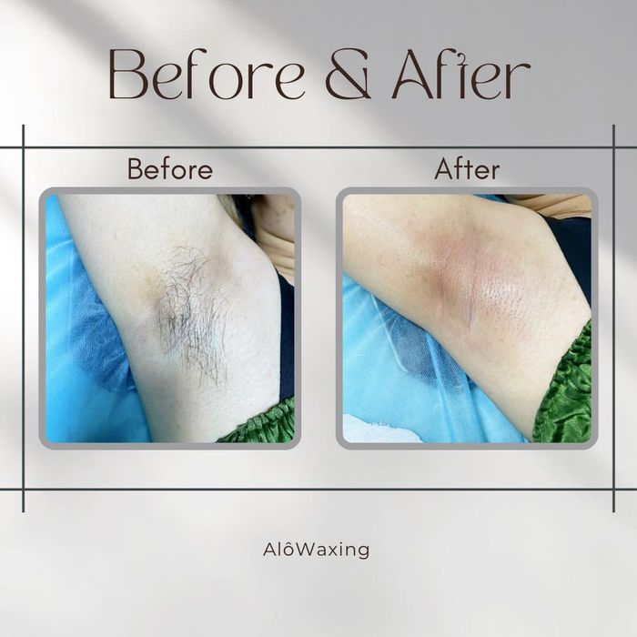 Ảnh 1 của Alô Waxing