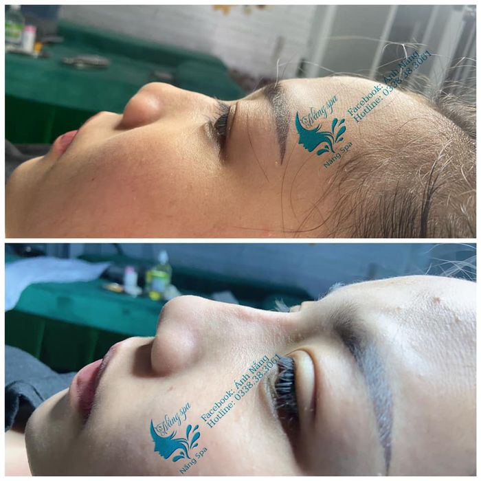 Ảnh của Nắng Spa 2