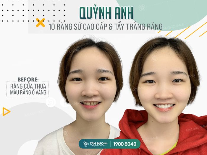 Hình ảnh Nha Khoa Tâm Đức Smile - Cần Thơ 1