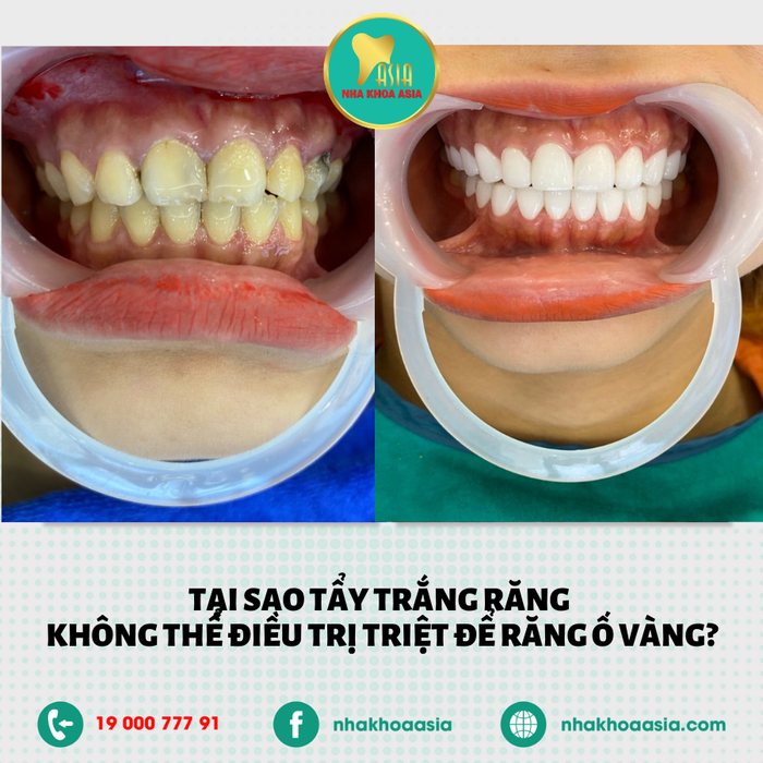 Nha Khoa Thẩm Mỹ Asia – Hình ảnh 1