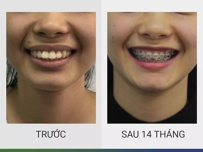 Hình ảnh Nha Khoa HẢI ÂU 1