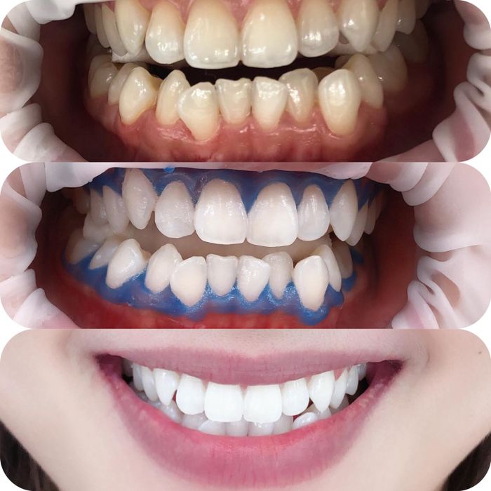 Hình ảnh Nha Khoa Miền Tây