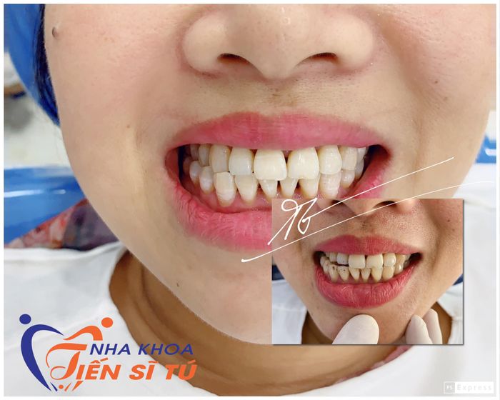 Nha Khoa Tiến Sĩ Tú hình ảnh 1