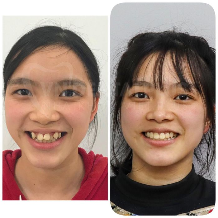 Hình ảnh 1 của Nha Khoa Việt Plus
