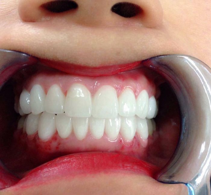 Ảnh 1 tại NHA KHOA QUỐC TẾ VIỆT ĐỨC