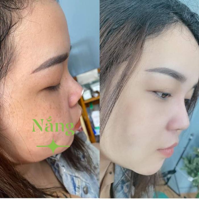 Ảnh của Nắng Spa 1
