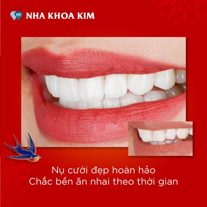 Nha khoa Kim – An Dương Vương hình ảnh 2