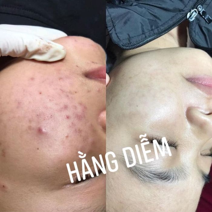 Hình ảnh Sline Spa - Hà Tĩnh 1
