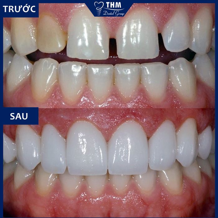 Hình ảnh Nha Khoa Thế Hệ Mới 1