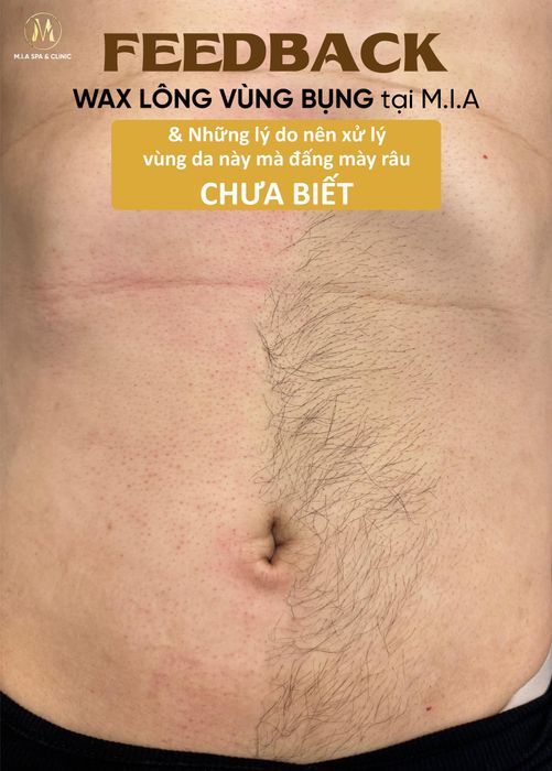 Ảnh 1 của M.I.A Spa - Waxing Cần Thơ
