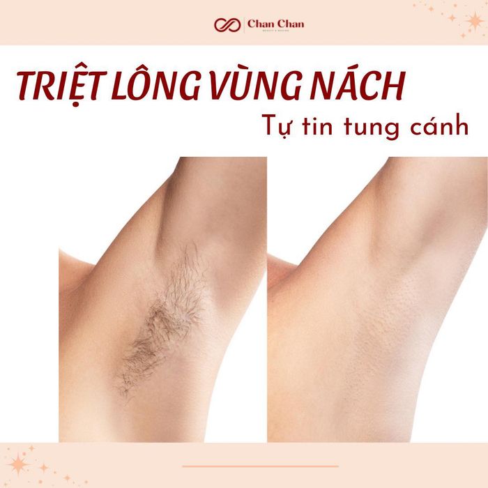 Hình ảnh Chang Waxing - Beauty & Spa 2