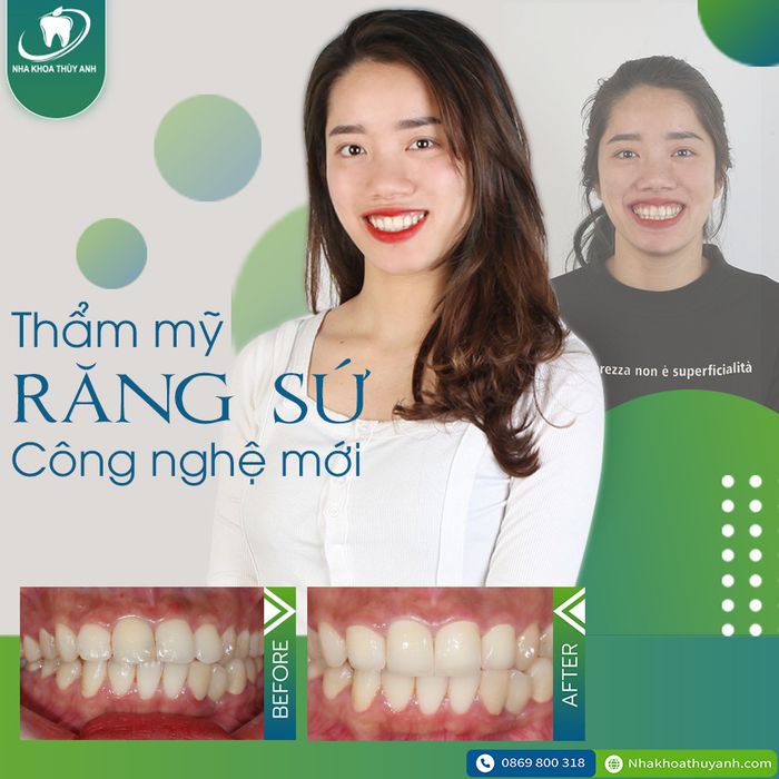 Hình ảnh Nha Khoa Thùy Anh 1