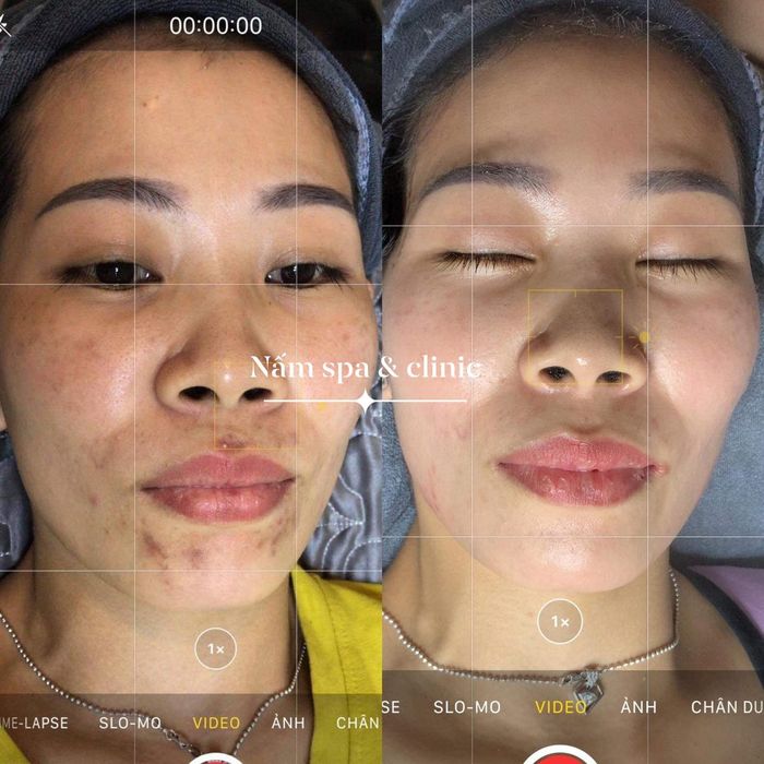 Hình ảnh Nấm Spa số 2