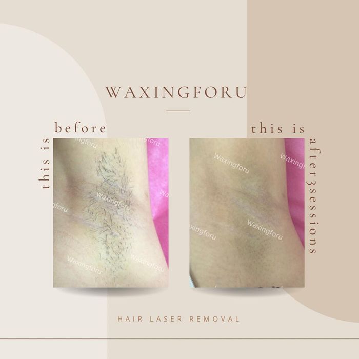 Ảnh 1 của Waxing For You
