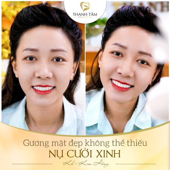 Hình ảnh Nha Khoa Thanh Tâm