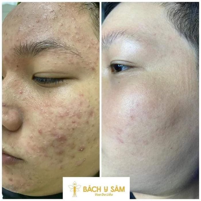 Hình ảnh Spa Nhật Linh