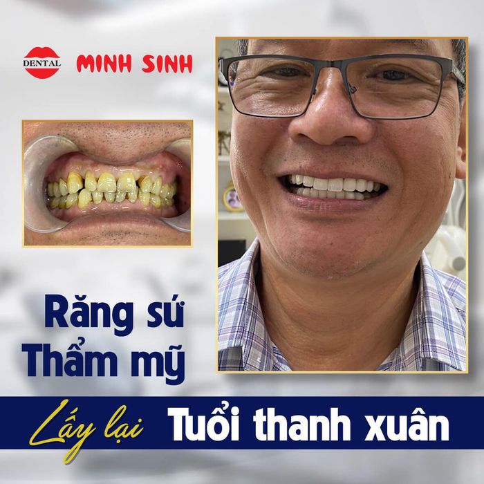 NHA KHOA MINH SINH hình 2