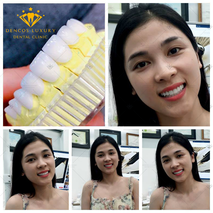 Hình ảnh của Dencos Luxury - Viện nha khoa thẩm mỹ Thanh Hóa