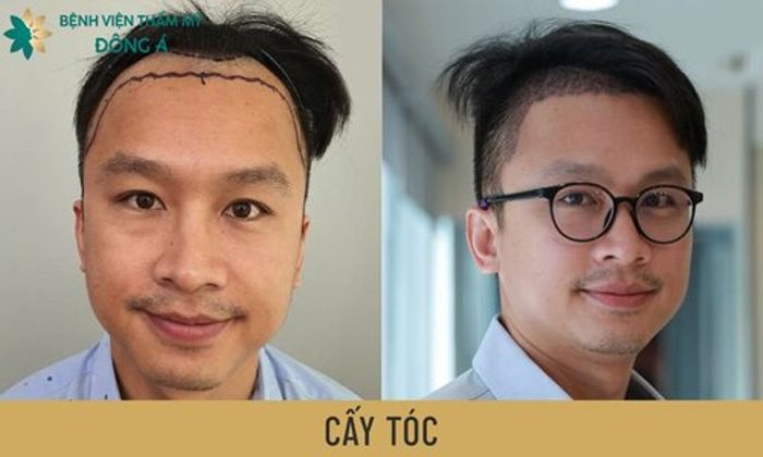 Hình ảnh Bệnh viện Thẩm mỹ Đông Á 3