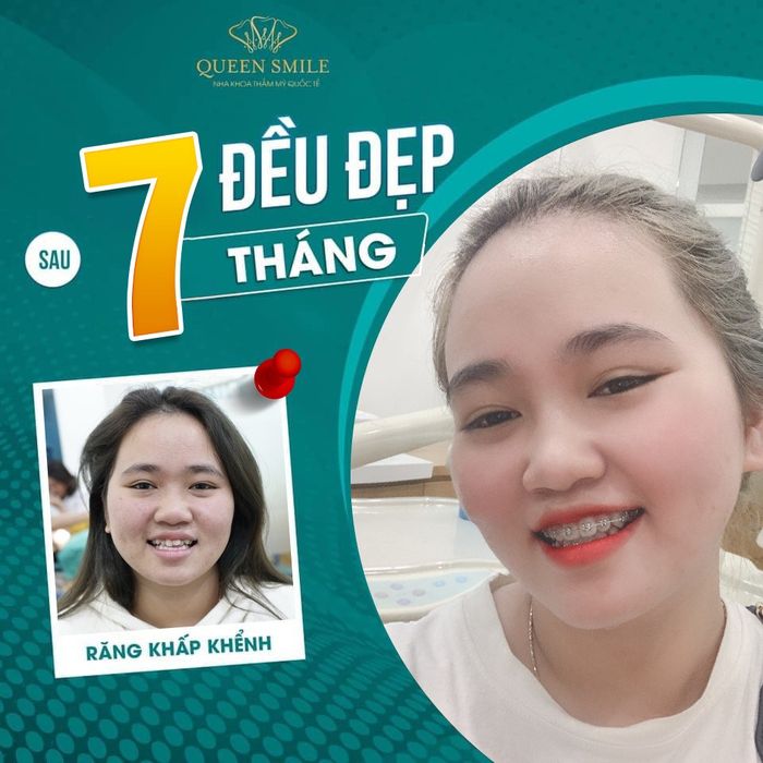 Nha khoa thẩm mỹ Queen Smile - Hình ảnh 1