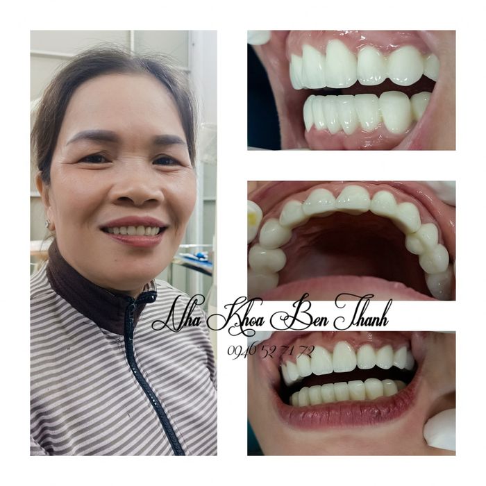 Hình ảnh Nha Khoa Bến Thành số 1