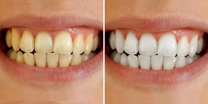 Hình ảnh 2 của Nha Khoa Ánh Dương tại Ninh Bình