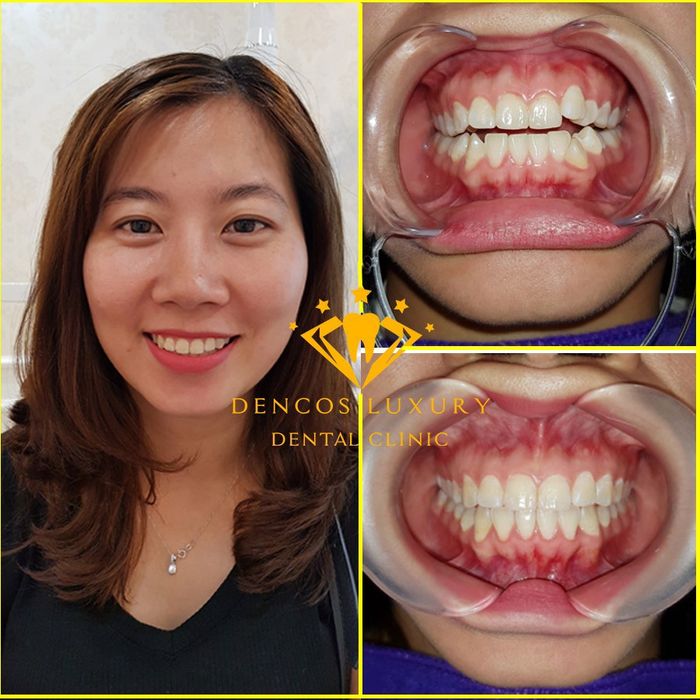 Hình ảnh 2 của Dencos Luxury - Trung tâm nha khoa thẩm mỹ Thanh Hóa