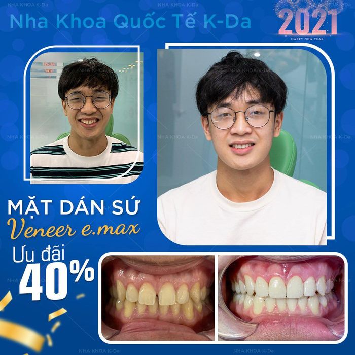 Nha Khoa Quốc Tế K-Da hình 2
