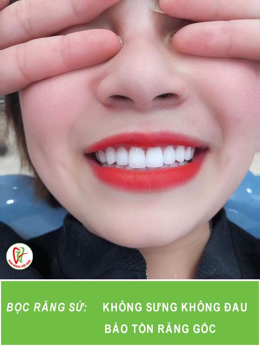 Ảnh Nha Khoa Việt Đức 2